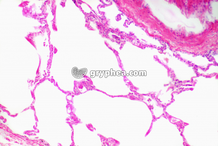 Poumon humain CT x10 - gryphea.org